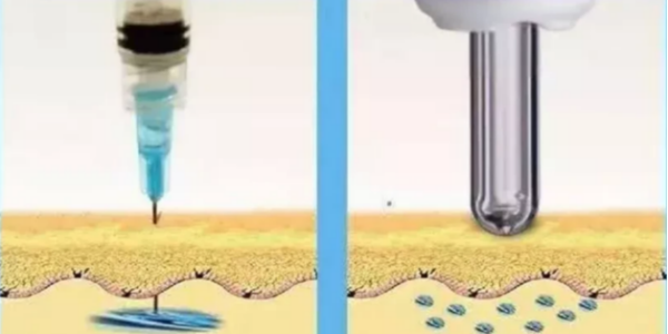 看完無針胰島素注射器的優缺點