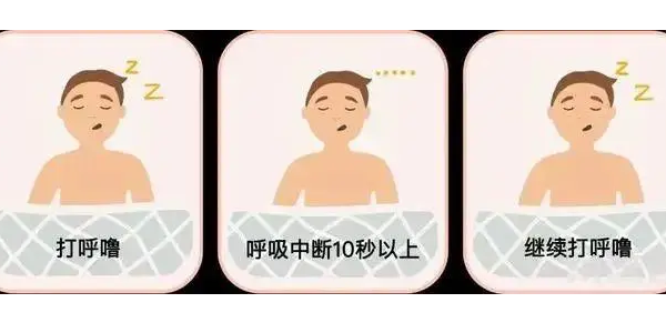 你真的了解睡眠呼吸暫停嗎？6600萬中重度患者正在受害！—仟龍醫(yī)療