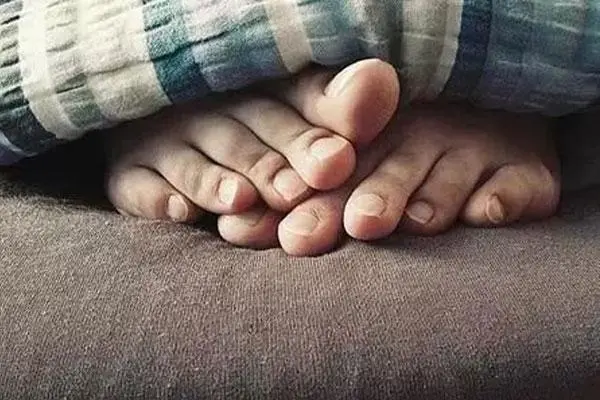腳臭