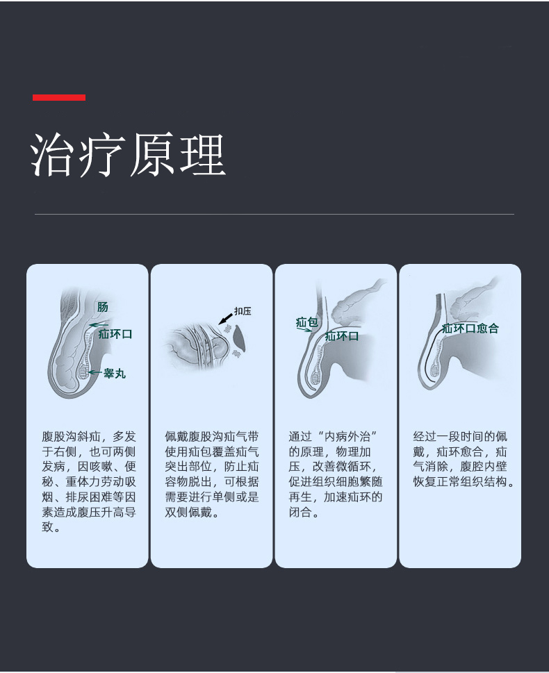 如何治療疝氣